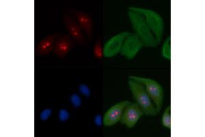 ABIN6263193 and ABIN6266724 staining Hela cells by IF/ICC. (MED24 Antikörper  (C-Term))