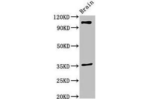 Western Blot Positive WB detected in: Mouse brain tissue All lanes: SLITRK5 antibody at 2 μg/mL Secondary Goat polyclonal to rabbit IgG at 1/50000 dilution Predicted band size: 108, 80 kDa Observed band size: 108 kDa (SLITRK5 Antikörper  (AA 617-890))