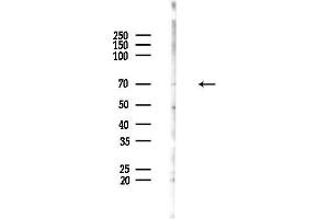 Western blot analysis of lysates from HUVEC cells(LPS,4h treatment), using Cytoplasmic dynein 1 intermediate chain 1 Antibody at 1/1000 dilution.