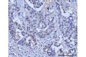 IHC analysis of RAD51C using anti-RAD51C antibody (ABIN7599718).