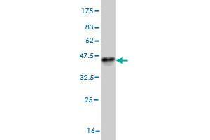Western Blotting (WB) image for anti-serine/threonine Kinase 38 (STK38) (AA 365-465) antibody (ABIN7199721)