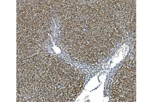 IHC analysis of ASS1 using anti-ASS1 antibody (ABIN7601191). (ASS1 Antikörper  (AA 3-365))