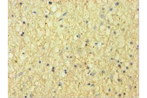 Immunohistochemistry of paraffin-embedded human brain tissue using ABIN7145442 at dilution of 1:100 (CNDP1 Antikörper  (AA 1-280))