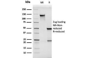 SDS-PAGE Analysis Purified MCAM Mouse Monoclonal Antibody (MCAM/3046). (MCAM Antikörper  (AA 226-374))