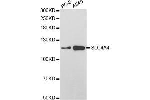 Western Blotting (WB) image for anti-Solute Carrier Family 4, Sodium Bicarbonate Cotransporter, Member 4 (SLC4A4) antibody (ABIN1876520)