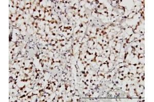 Image no. 3 for anti-Ubiquitin Specific Peptidase 34 (USP34) (AA 3296-3396) antibody (ABIN599094) (USP34 Antikörper  (AA 3296-3396))