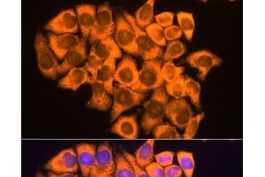 Immunofluorescence analysis of HeLa cells using RPL17 Polyclonal Antibody at dilution of 1:100. (RPL17 Antikörper)