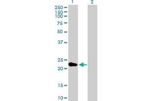 Western Blot analysis of CRYBA2 expression in transfected 293T cell line by CRYBA2 MaxPab polyclonal antibody. (CRYbA2 Antikörper  (AA 1-197))