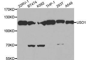 Western blot analysis of extracts of various cell lines, using USO1 antibody (ABIN1875291) at 1:500 dilution. (USO1 Antikörper)