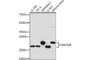 Western blot analysis of extracts of various cell lines, using B Rabbit mAb (ABIN7265377) at 1:1000 dilution. (ANP32B Antikörper)