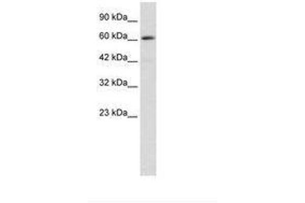 ZBTB45 Antikörper  (AA 200-249)