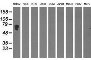 Western blot analysis of extracts (35 µg) from 9 different cell lines by using anti-AFP monoclonal antibody. (alpha Fetoprotein Antikörper)