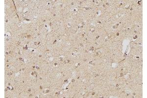 ABIN6261810 and ABIN6268934 at 1/100 staining Human brain tissue by IHC-P. (FOXP3 Antikörper  (C-Term))