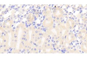 Detection of a4GALT in Mouse Kidney Tissue using Polyclonal Antibody to Alpha-1,4-Galactosyltransferase (a4GALT) (A4GALT Antikörper  (AA 94-270))