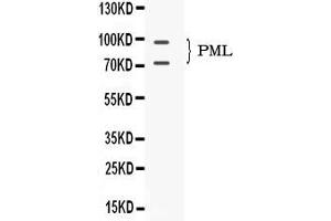 Western blot analysis of PML Protein expression in mouse testis extract ( Lane 1). (PML Antikörper  (N-Term))