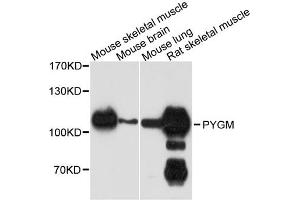 Western blot analysis of extracts of various cell lines, using PYGM antibody. (PYGM Antikörper)