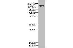 Western blot All lanes: PLXNB2 antibody IgG at 2. (Plexin B2 Antikörper  (AA 1080-1200))