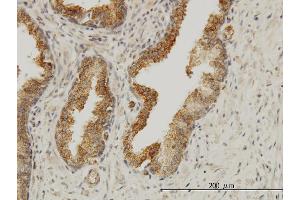 Immunostaining (ISt) image for anti-Achalasia, Adrenocortical Insufficiency, Alacrimia (AAAS) (AA 1-100) antibody (ABIN563541)