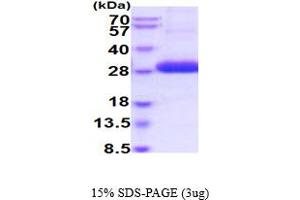 SDS-PAGE (SDS) image for UL16 Binding Protein 2 (ULBP2) (AA 26-216) protein (His tag) (ABIN5854768) (ULBP2 Protein (AA 26-216) (His tag))