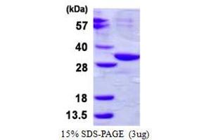 Abhydrolase Domain Containing 10 (ABHD10) (AA 53-306) protein (His tag)
