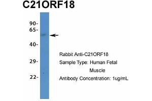 Host:  Rabbit  Target Name:  C21ORF18  Sample Type:  Human Fetal Muscle  Antibody Dilution:  1. (SETD4 Antikörper  (C-Term))
