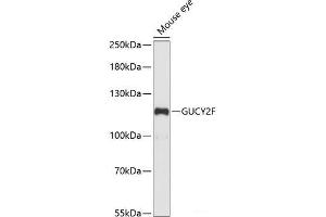 Western blot analysis of extracts of Mouse eye using GUCY2F Polyclonal Antibody at dilution of 1:1000.