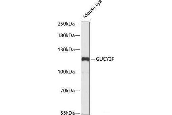 GUCY2F Antikörper