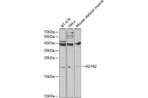 Western blot analysis of extracts of various cell lines, using HSPB2 antibody (ABIN6131082, ABIN6142054, ABIN6142055 and ABIN6219505) at 1:1000 dilution.