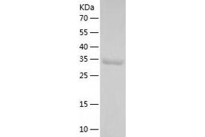 Western Blotting (WB) image for Pyridoxal (Pyridoxine, Vitamin B6) Phosphatase (PDXP) (AA 1-296) protein (His tag) (ABIN7124711) (PDXP Protein (AA 1-296) (His tag))