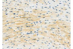 ABIN6261824 and ABIN6273118 at 1/100 staining Mouse heart tissue by IHC-P. (FSTL1 Antikörper  (N-Term))