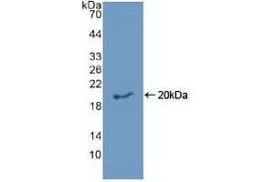 Western blot analysis of recombinant Human EREG. (Epiregulin Antikörper  (AA 30-169))