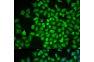Immunofluorescence analysis of HeLa cells using COPS5 Polyclonal Antibody (COPS5 Antikörper)