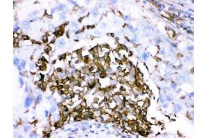 IHC analysis of CD18/ITGB2 using anti-CD18/ITGB2 antibody (ABIN3043260).