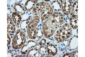 Immunohistochemical staining of paraffin-embedded prostate tissue using anti-TPMT mouse monoclonal antibody. (TPMT Antikörper)