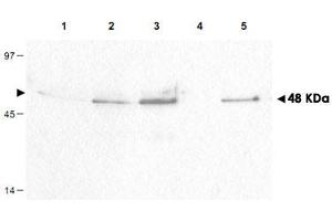 Western blot using CCNB1 (phospho S126) polyclonal antibody  shows detection of a band ~48 kDa corresponding to phosphorylated human CCNB1 (arrowheads) in various whole cell lysates. (Cyclin B1 Antikörper  (pSer126))