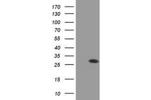 Western Blotting (WB) image for anti-Proteasome (Prosome, Macropain) Subunit, beta Type, 9 (Large Multifunctional Peptidase 2) (PSMB9) (AA 21-219) antibody (ABIN1491190) (PSMB9 Antikörper  (AA 21-219))