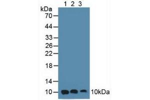 Figure. (S100A6 Antikörper  (AA 1-90))