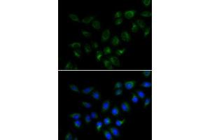 Immunofluorescence analysis of MCF7 cells using BMP15 antibody (ABIN6127524, ABIN6137593, ABIN6137594 and ABIN6223163). (BMP15 Antikörper  (AA 143-392))