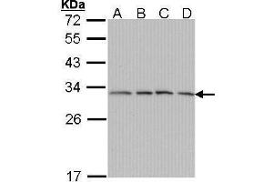 WB Image Sample (30 ug of whole cell lysate) A: A431 , B: H1299 C: Hela D: Hep G2 , 12% SDS PAGE antibody diluted at 1:1000 (PSMA7 Antikörper  (Center))