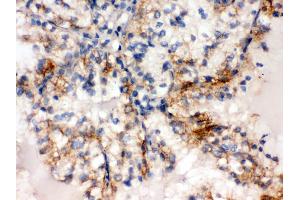 Immunohistochemistry (Paraffin-embedded Sections) (IHC (p)) image for anti-Sulfotransferase Family, Cytosolic, 2A, Dehydroepiandrosterone (DHEA)-Preferring, Member 1 (SULT2A1) (AA 253-285), (C-Term) antibody (ABIN3043941) (SULT2A1 Antikörper  (C-Term))