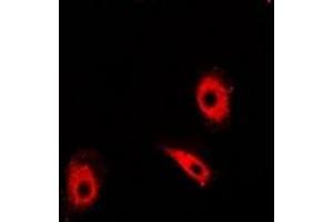 Immunofluorescent analysis of TIM staining in Hela cells. (TPI1 Antikörper)