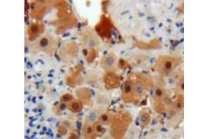 Used in DAB staining on fromalin fixed paraffin-embedded Liver tissue (PSMD10 Antikörper  (AA 1-226))