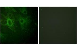 Immunofluorescence analysis of HeLa cells, using HCK (Phospho-Tyr410) Antibody. (HCK Antikörper  (pTyr410))