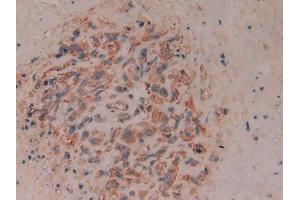 Immunohistochemistry (IHC) image for anti-CD8b Molecule (CD8B) (AA 22-170) antibody (ABIN1858318)