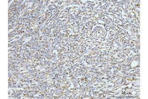 IHC analysis of GRPEL1 using anti-GRPEL1 antibody (ABIN7602643).