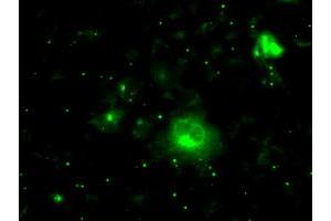 Anti-PRL mouse monoclonal antibody (ABIN2453519) immunofluorescent staining of COS7 cells transiently transfected by pCMV6-ENTRY PRL (RC205627). (Prolactin Antikörper)