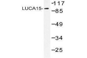 Western blot (WB) analysis of LUCA15 antibody in extracts from HHUVEC cells. (RBM5 Antikörper)