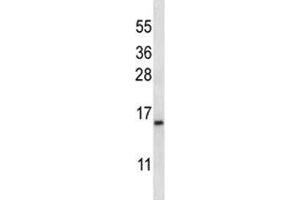 BAFF antibody western blot analysis in K562 lysate. (TNFRSF13C Antikörper  (AA 1-30))
