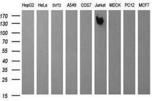 Image no. 2 for anti-Protein tyrosine Phosphatase, Receptor Type, C (PTPRC) antibody (ABIN1497330) (CD45 Antikörper)