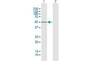 Western Blotting (WB) image for anti-Protein Kinase, CAMP-Dependent, Regulatory, Type I, beta (PRKAR1B) (AA 1-381) antibody (ABIN519183)
